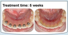 Photo of treatment times